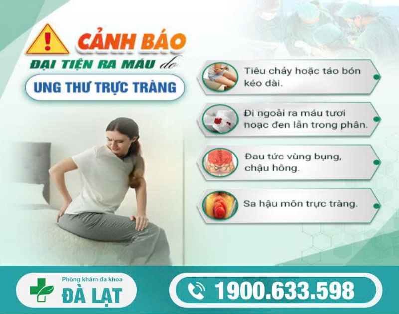 Hình ảnh minh họa